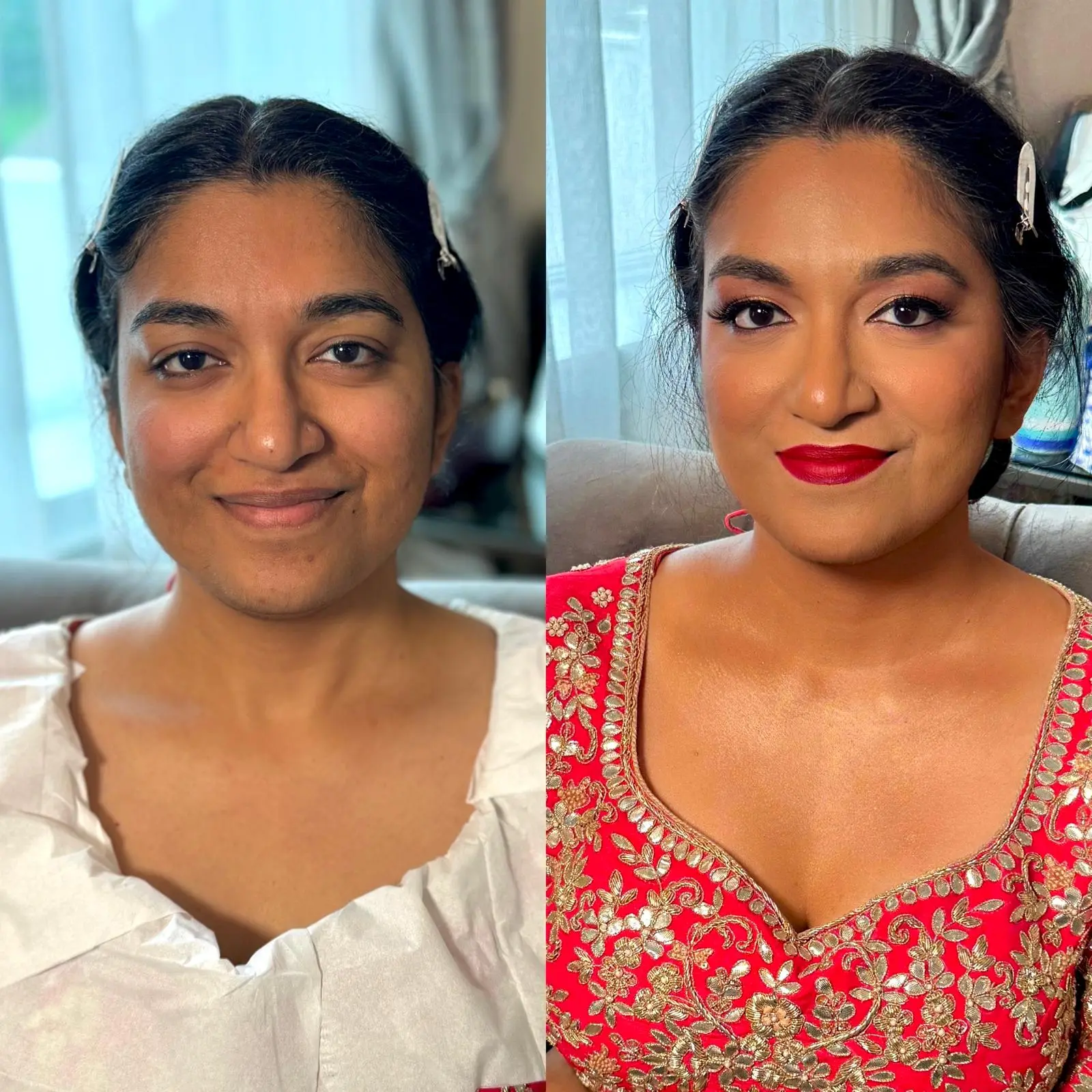 before after images (3)