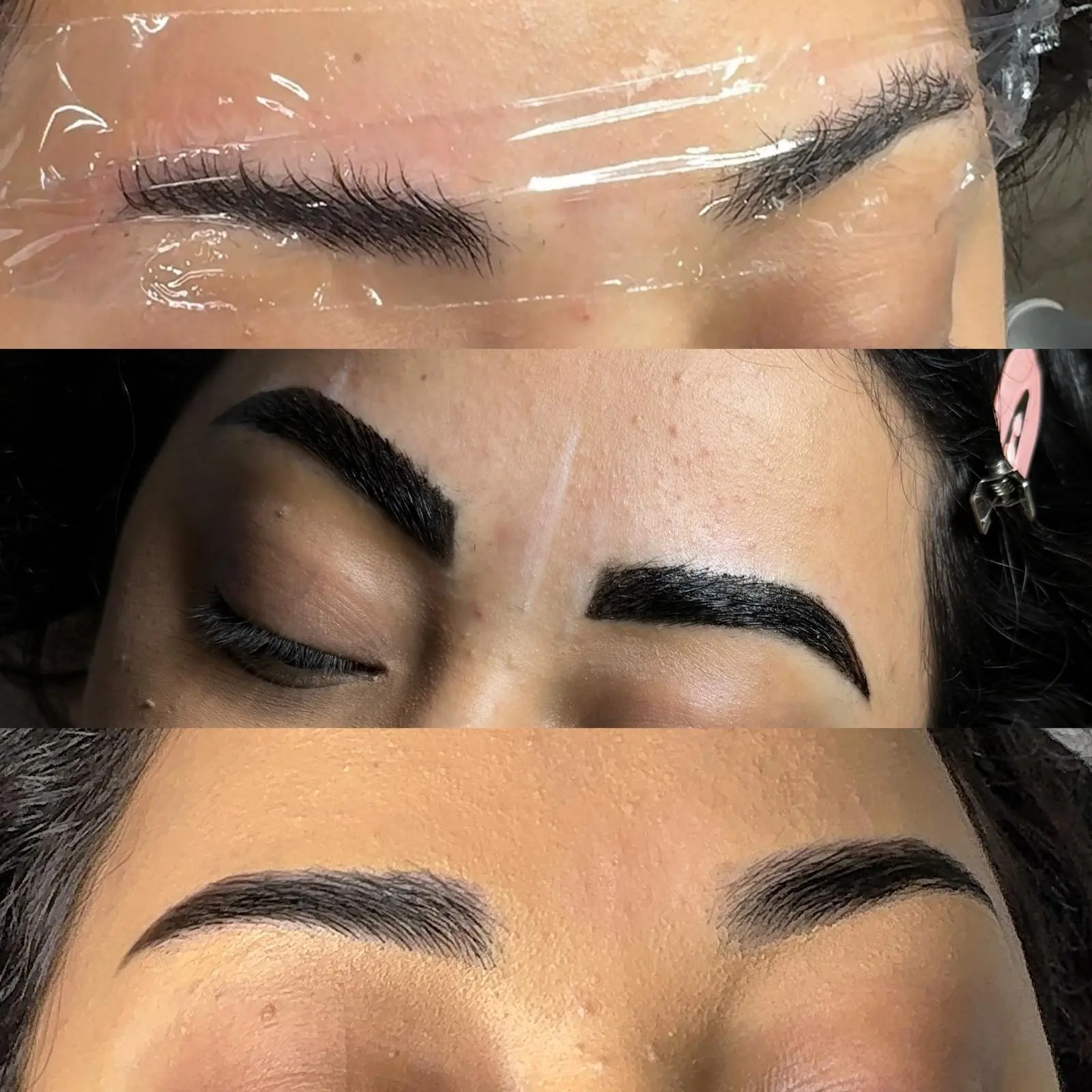 before after images (4)